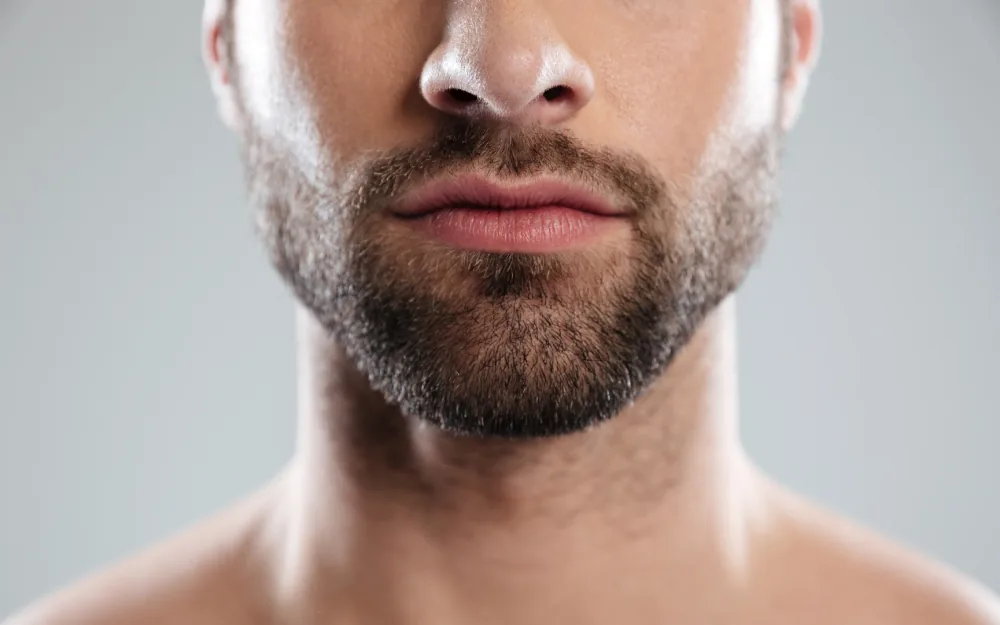 Mann mit gepflegtem Bart als Symbolbild für Barthaartransplantation