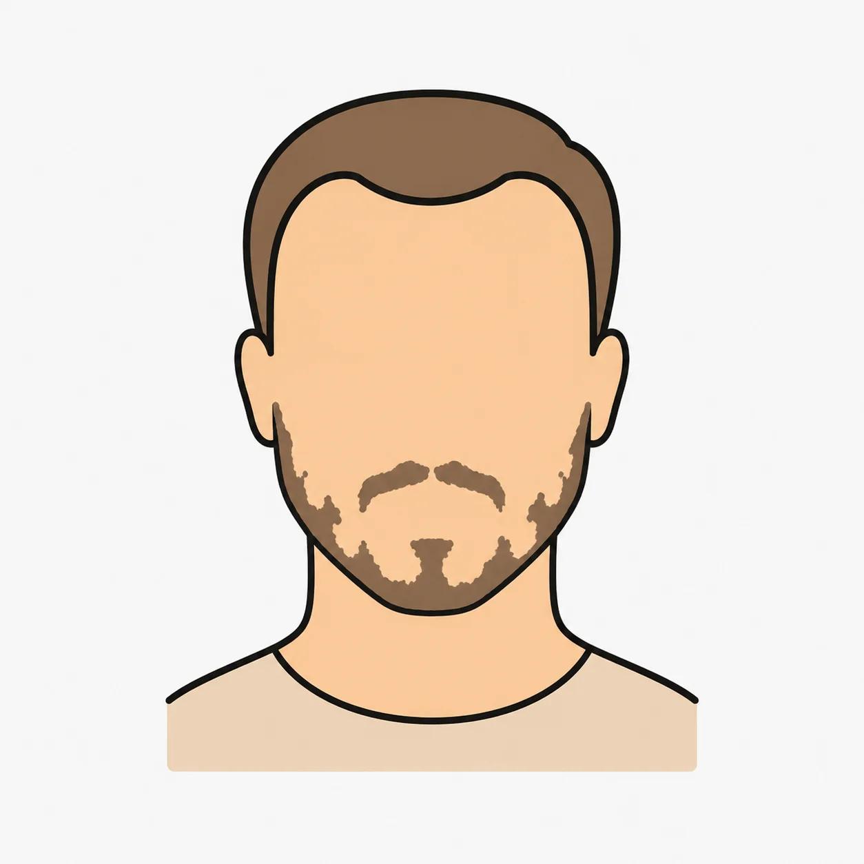 Illustration kahler Stellen an den Wangen vor einer möglichen Barttransplantation
