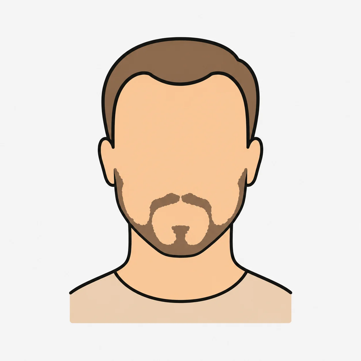 Illustration eines lückenhaften Bartes als mögliche Zone einer Barttransplantation